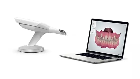 Digital intraoral scanner resting on its stand beside a laptop showing a dental scan